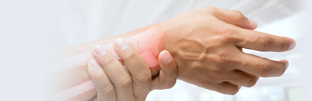 wrist pain slide image for Arthritis and Rheumatology Center, PC